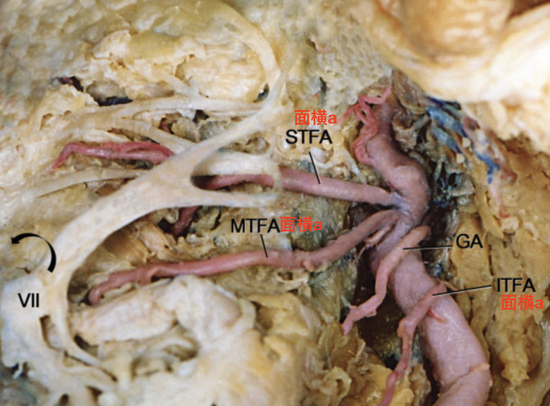 脑血管解剖学习笔记第17期:面横动脉