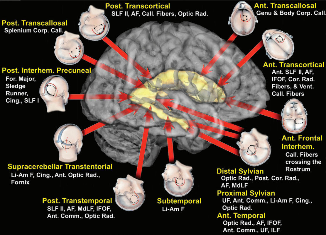 神外专题二大脑白质纤维束的解剖意义