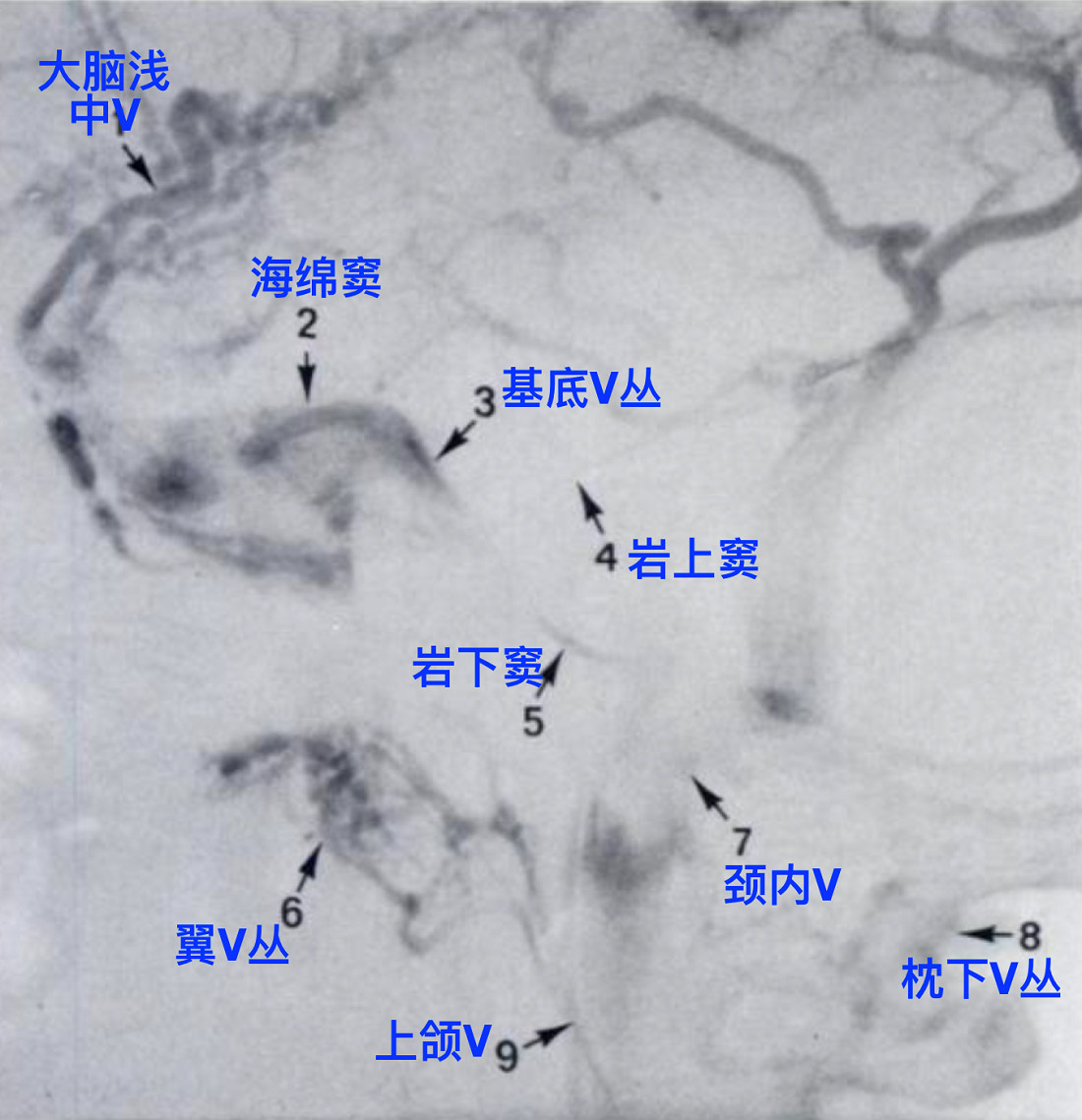 脑血管解剖学习笔记第26期翼静脉丛大体解剖