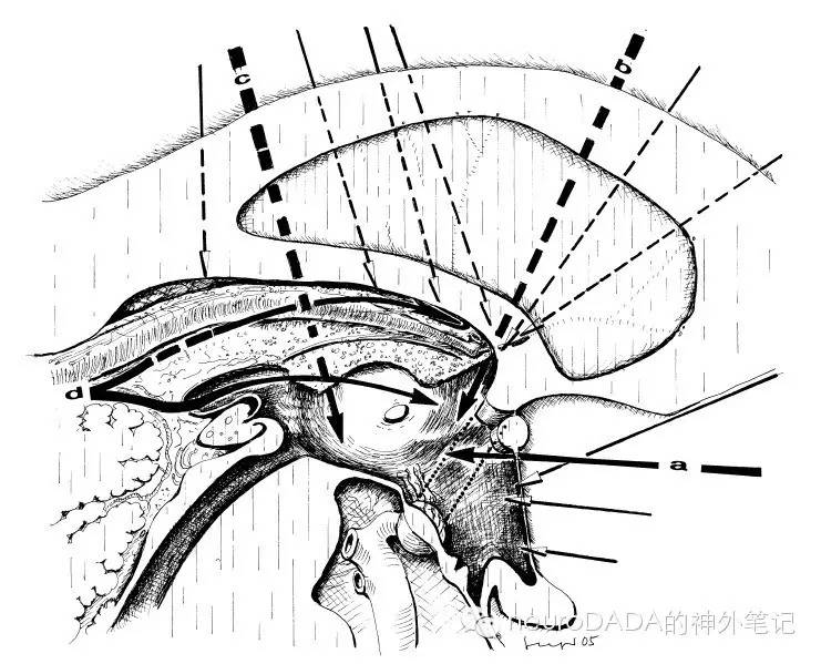 自说自画"脉络膜"