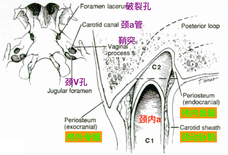 显示颈内动脉岩段与颈静脉孔,岩大神经,脑膜中动脉和颅神经的关系.