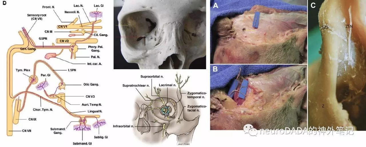 解剖小细节——颧颞静脉和神经