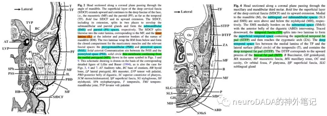 图19:头颈-颅底筋膜和间隙的冠状切面示意图