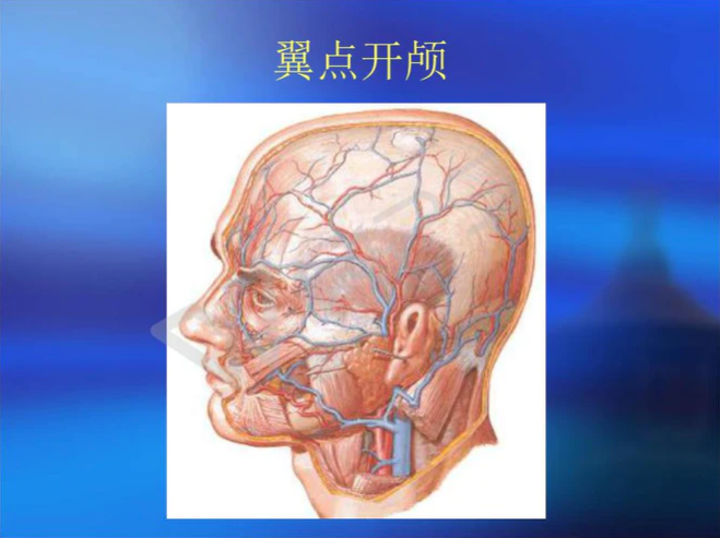 翼点入路筋膜间入路体会既往手术入路讲课回顾