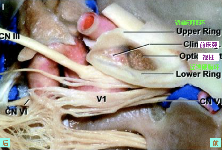 脑血管解剖学习笔记第35期:颈内动脉海绵窦段解剖