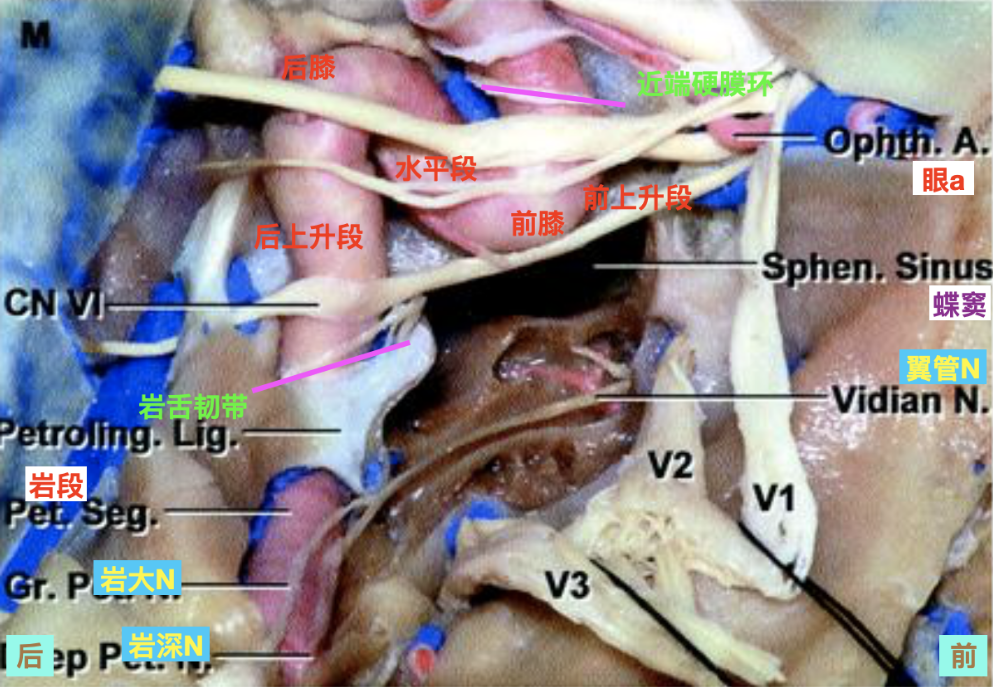 脑血管解剖学习笔记第35期:颈内动脉海绵窦段解剖