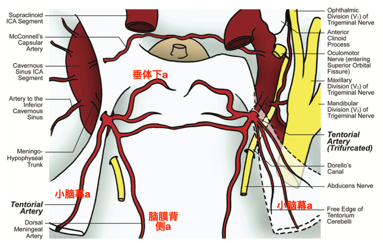 左侧小脑幕动脉双分叉发自脑膜垂体干的示意图(banerjee 2011).