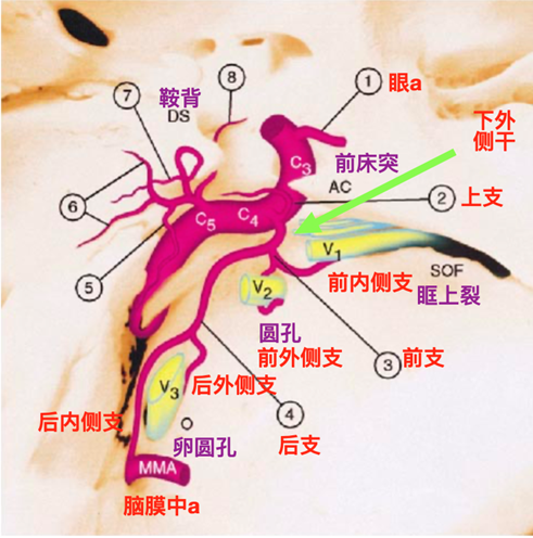 颈内动脉海绵窦段分支示意图(robinson 1999.