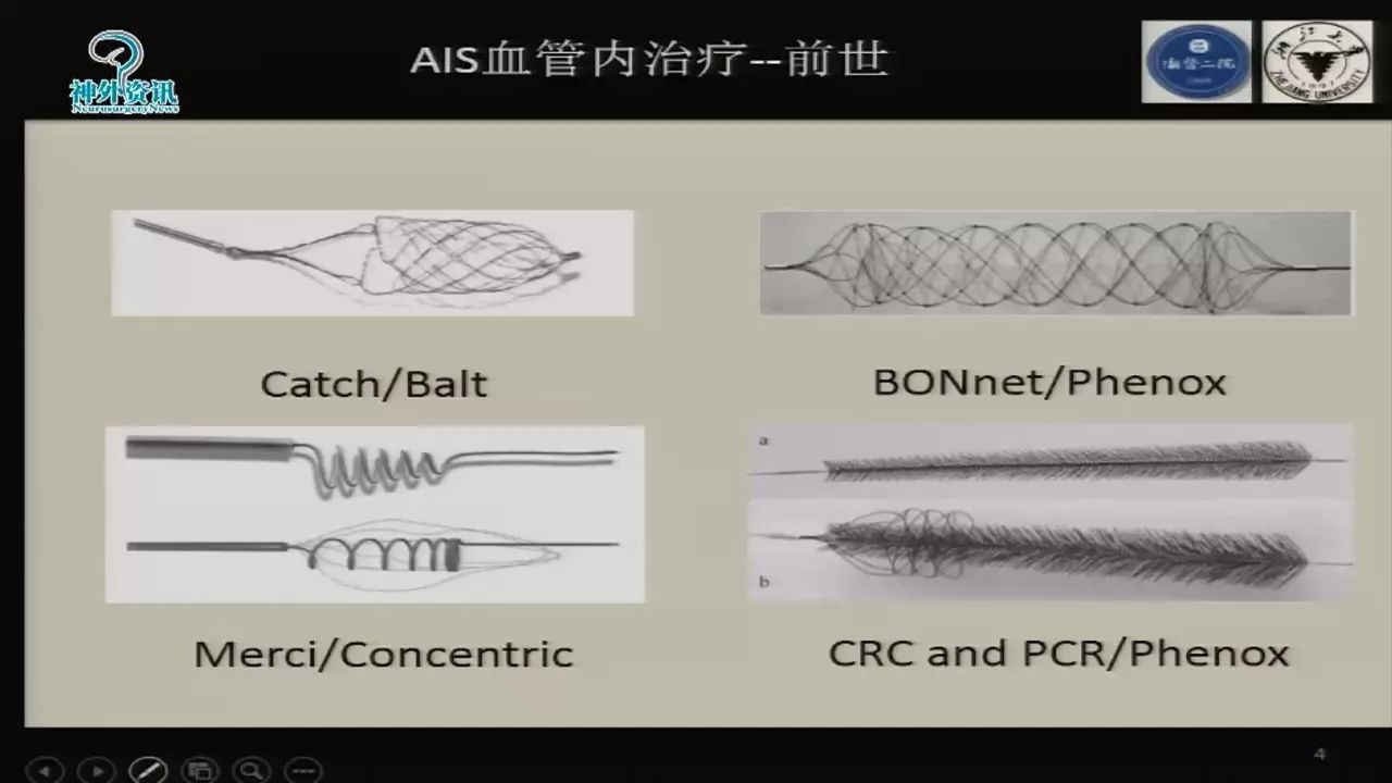 徐良:抽吸导管在ais血管内治疗中的应用体会丨第七届