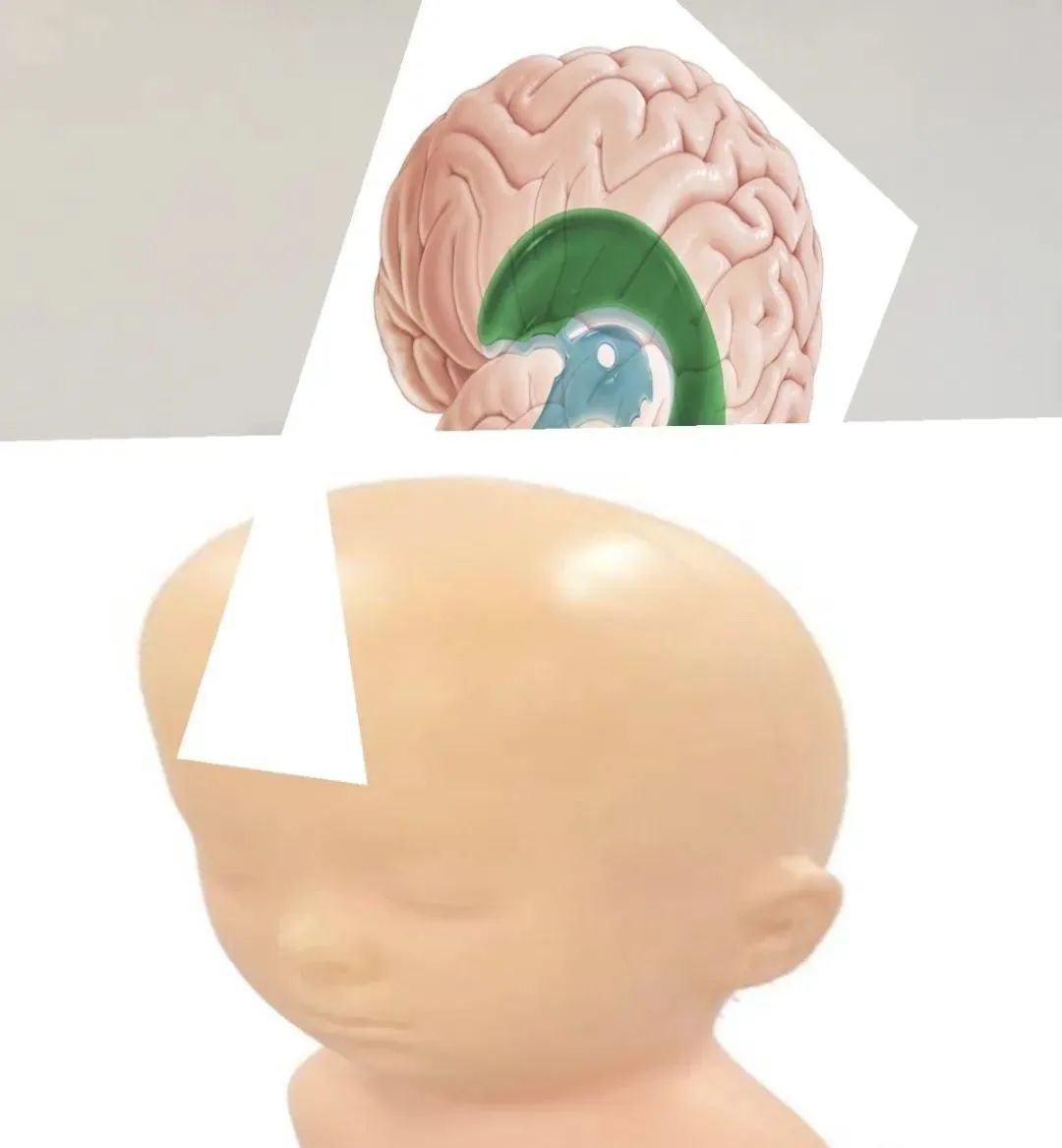 侧脑室的几张精彩解剖图
