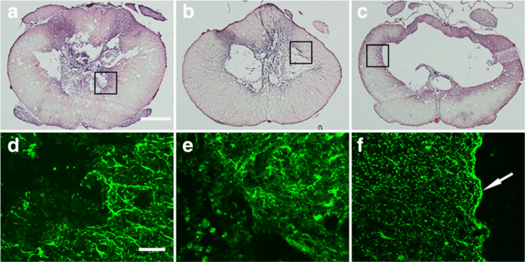 图1 大鼠脊髓组织切片,上方为he,下方为gfap免疫染色.
