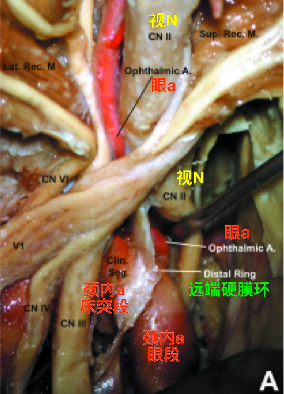 脑血管解剖学习笔记第43期:眼动脉大体解剖