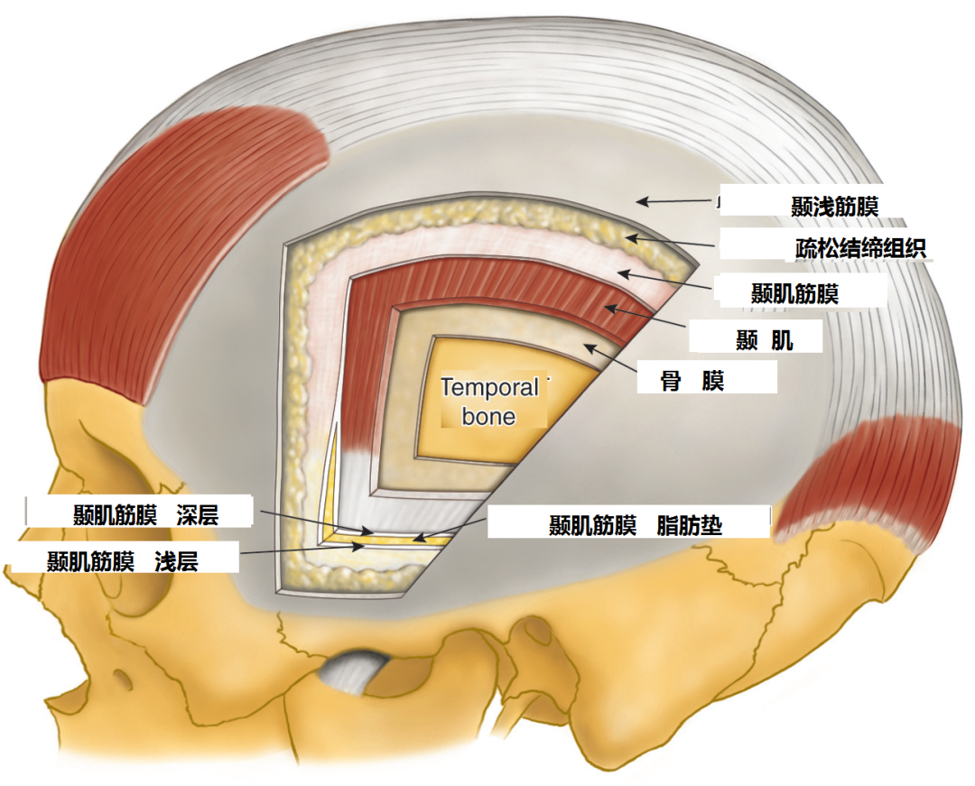 额部骨膜层在颞上线与颞肌筋膜浅层相互延续