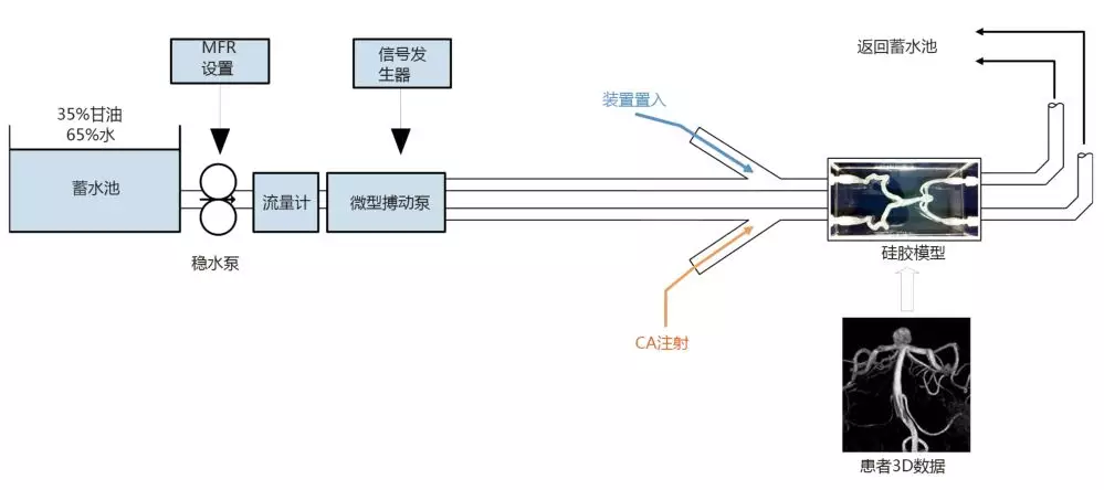 动脉瘤内血流动力学：评价pCONus和pCANvas分叉部动脉 瘤DSA光学血流影像 - 脑医汇 - 神外资讯 - 神介资讯