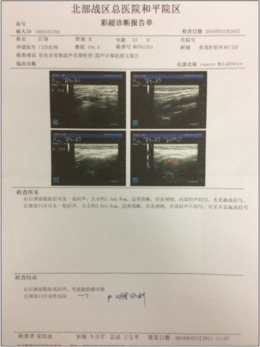 颈动脉超声报告模板图片
