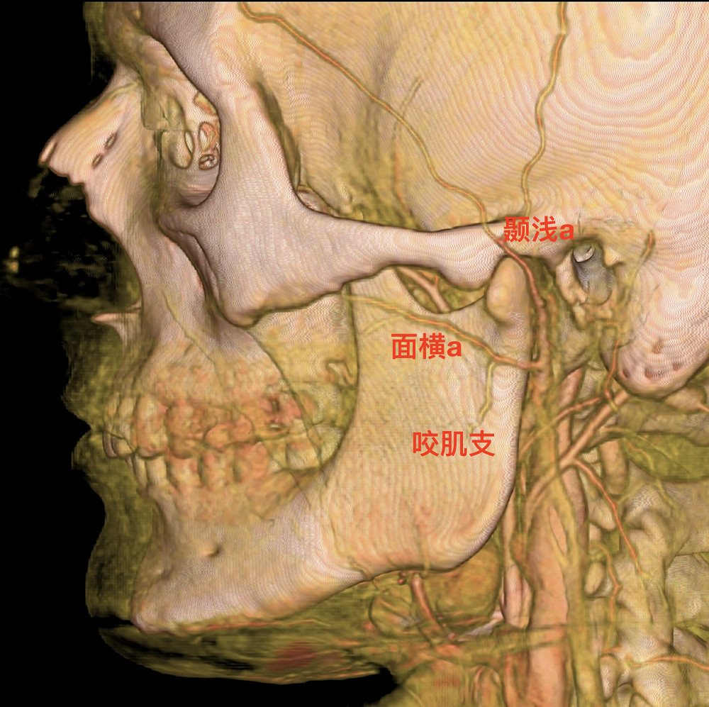 除了发出咬肌支,面横动脉还供应颧部前方区域,发出分支与颧眶动脉吻合