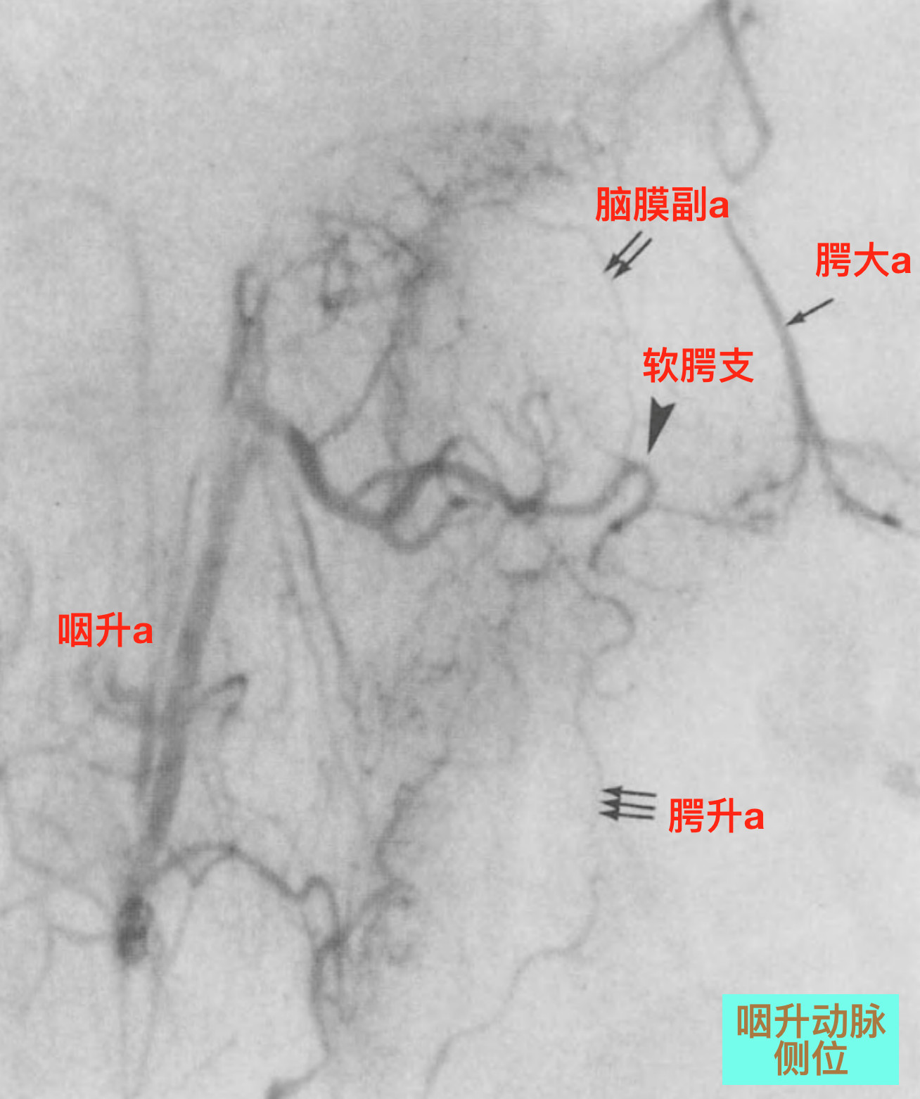 脑血管解剖学习笔记第19期面动脉颈部走行和分支