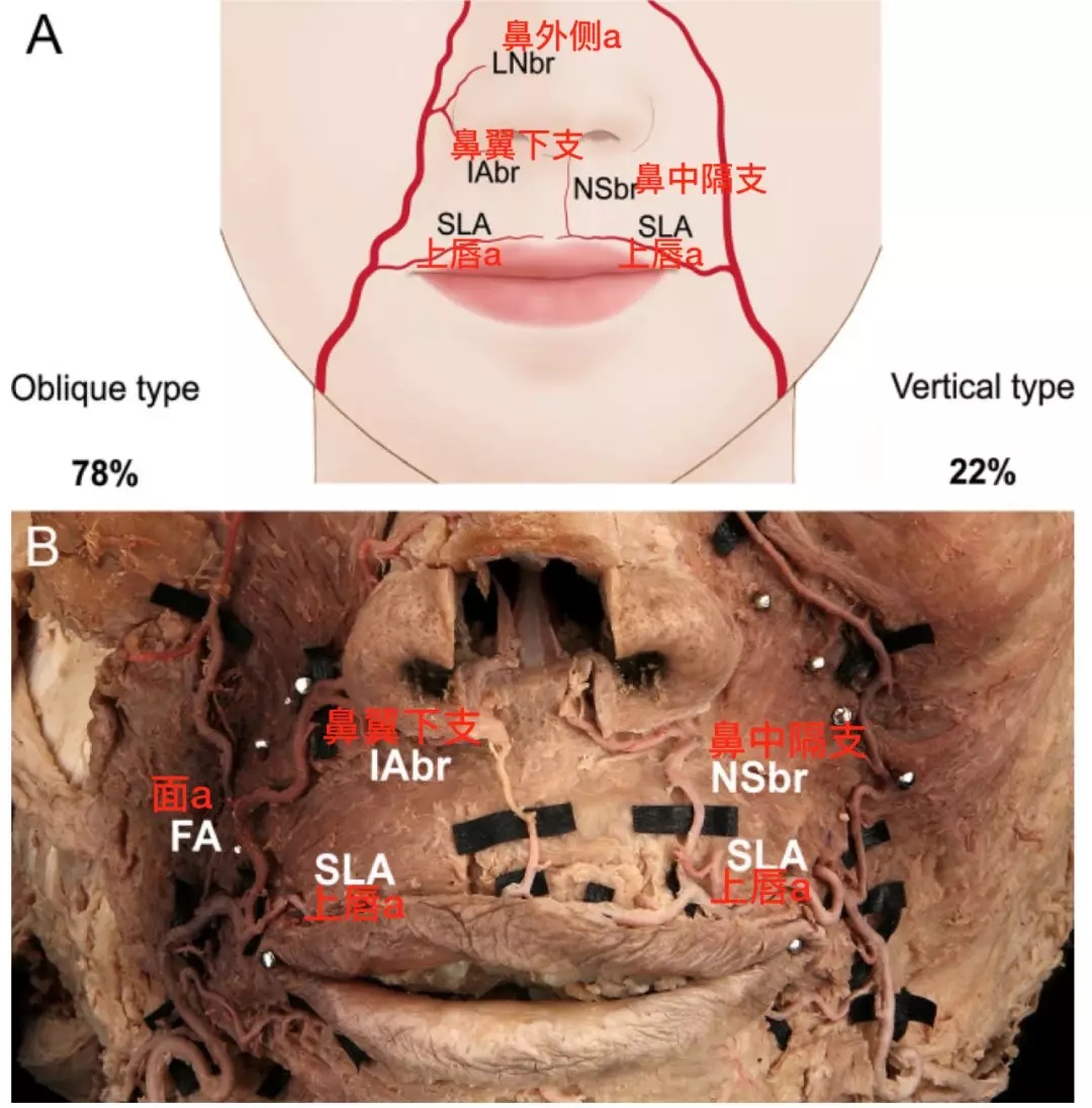 脑血管解剖学习笔记第20期:面动脉面部走行和分支