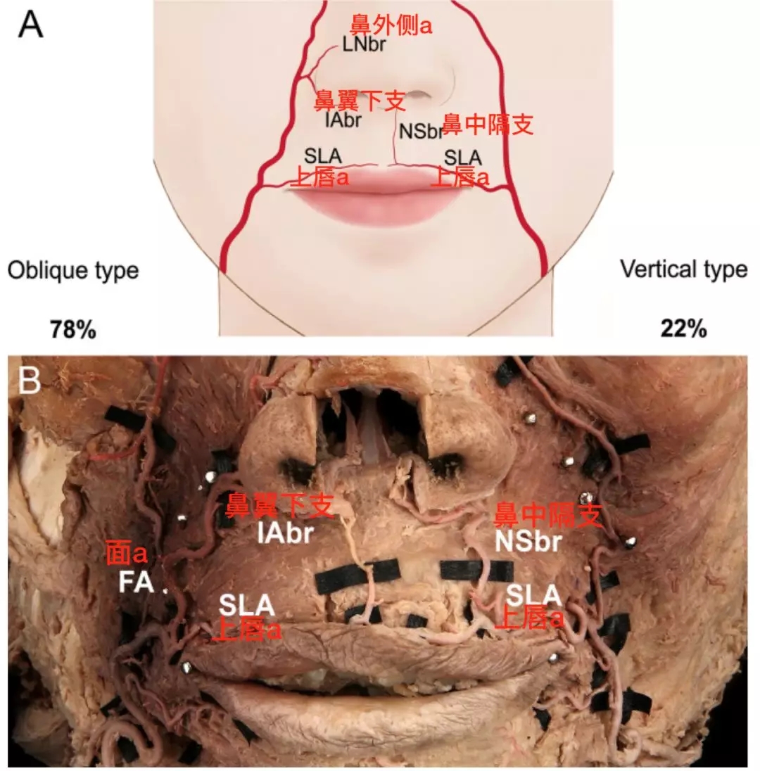 面部动脉分布图图片
