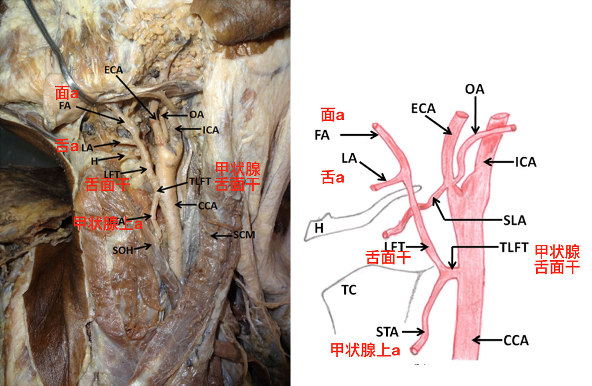 颏动脉图片