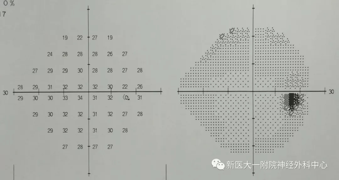 2.webp.jpg