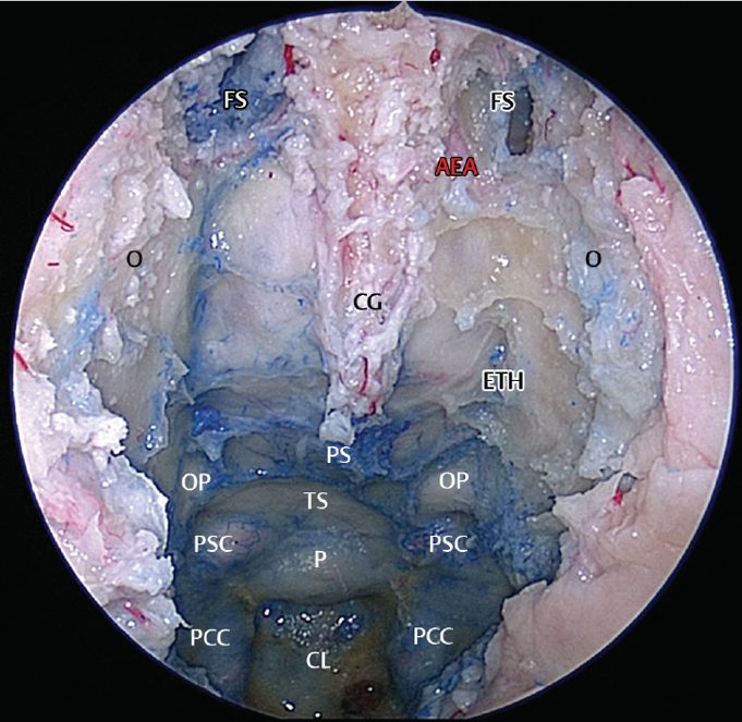 aea=筛前动脉;cg=鸡冠;cl=斜坡;eth=筛顶;fs=额窦;o=眼眶;op=视神经;p