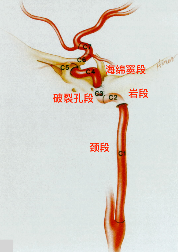 脑血管解剖学习笔记第32期颈内动脉岩段和破裂孔段解剖