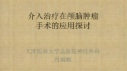 肖福顺教授：介入栓塞在颅底外科手术中的应用