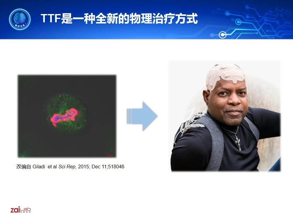 花瑋副教授腫瘤電場治療的分子機制研究新進展