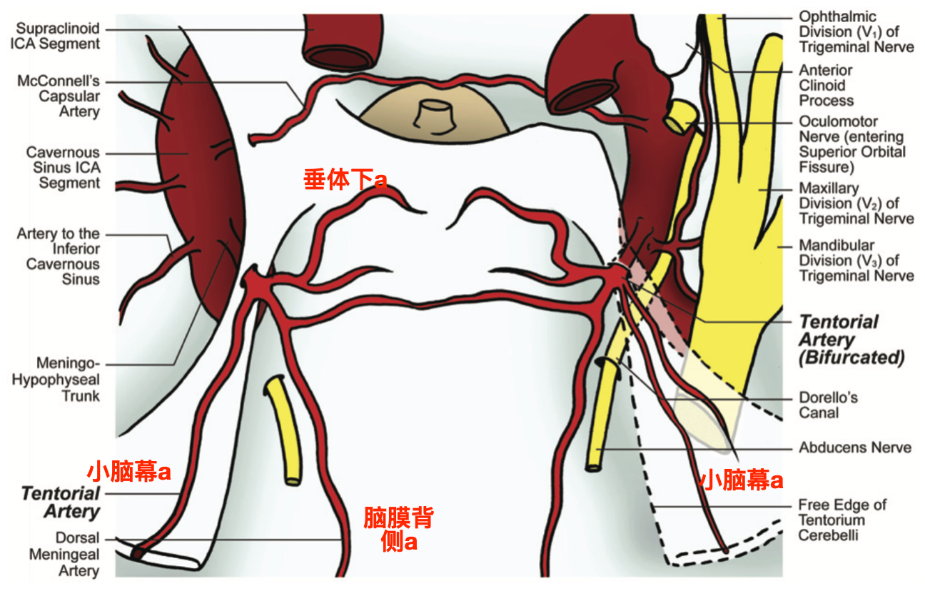 左侧小脑幕动脉双分叉发自脑膜垂体干的示意图(banerjee 2011).