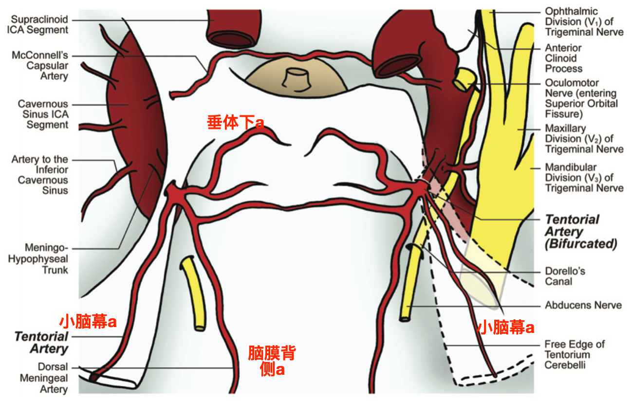 左侧小脑幕动脉双分叉发自脑膜垂体干的示意图(banerjee 2011.