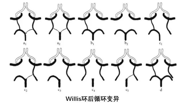 脑内的willis环你知道吗