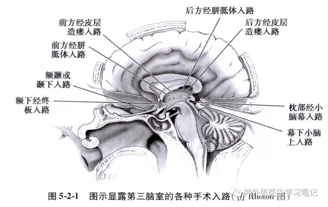 第三脑室的位置图片