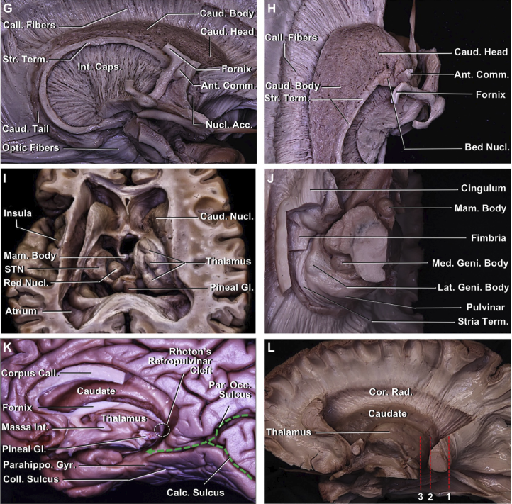 丘脑及其白质纤维束的解剖以及手术入路