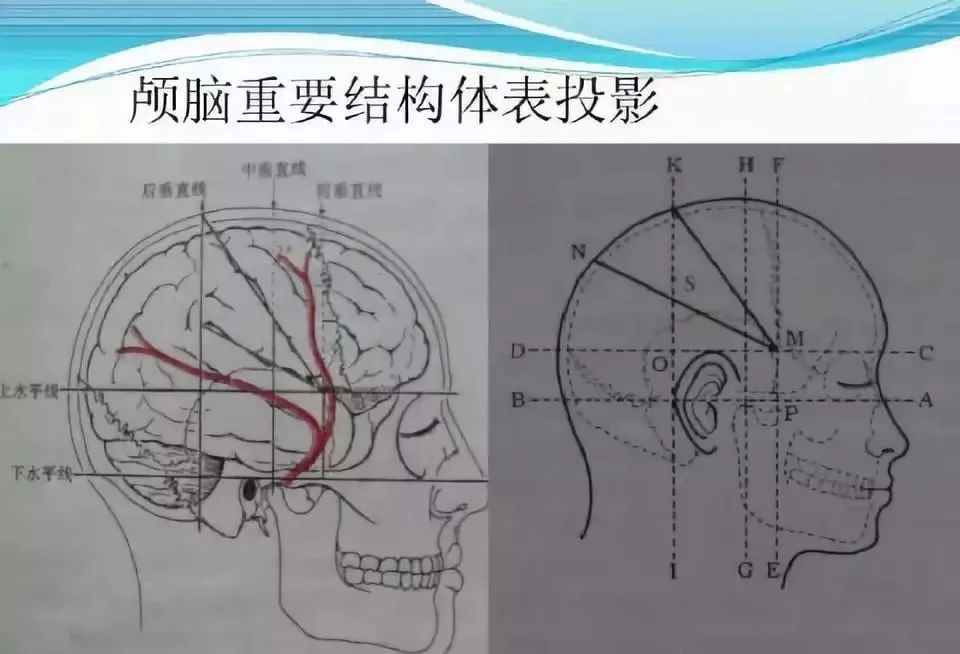 kronlein颅脑结构体表投影利用头部重要骨性标志:眉弓,眉间,颧弓,翼点