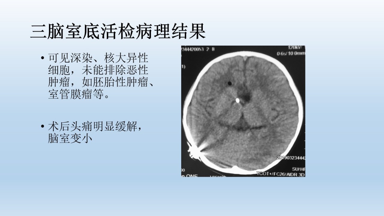 幻灯片14.jpg