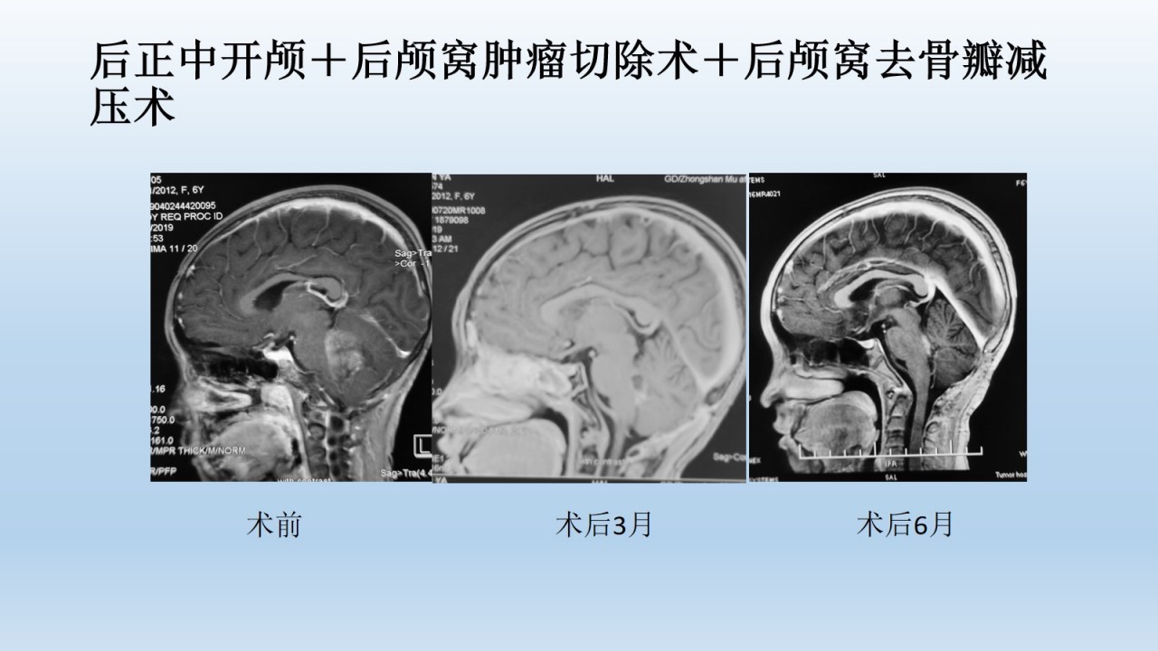 幻灯片16.jpg