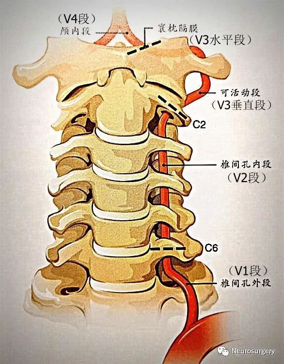 椎动脉血管的位置图片图片