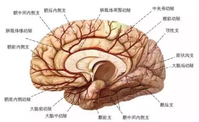 双侧大脑前动脉共干图片