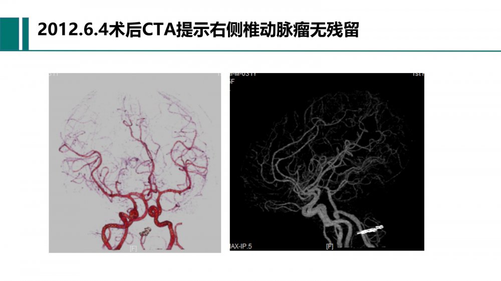 幻灯片12.jpg