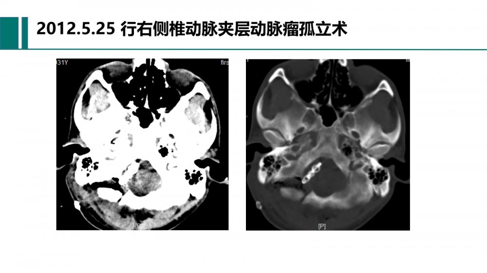 幻灯片11.jpg