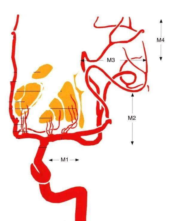 大脑中动脉的分段图解