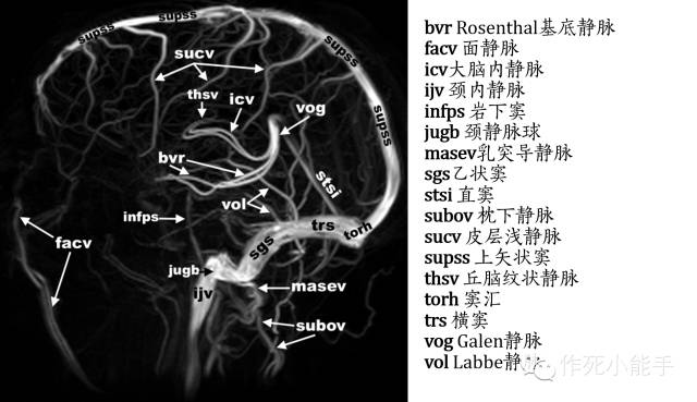 大脑静脉系统的解剖与影像
