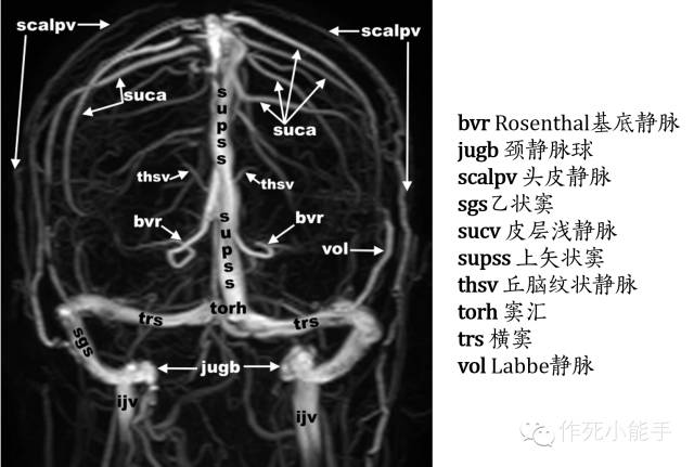 大腦靜脈系統的解剖與影像