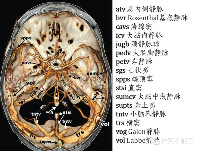 丘纹静脉与大脑内静脉的夹角比较明显的trolard静脉和labbe静脉海绵窦