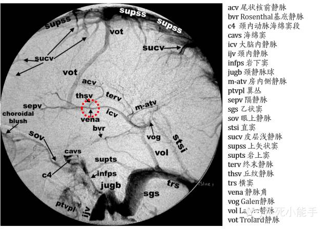 大脑静脉系统的解剖与影像