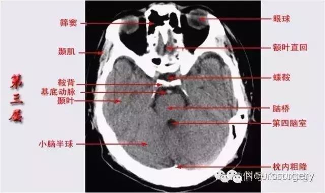 基底池解剖结构图片图片