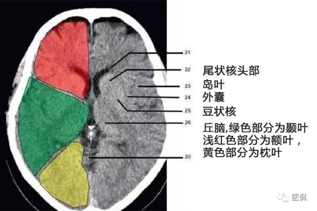 颅脑ct解剖口诀