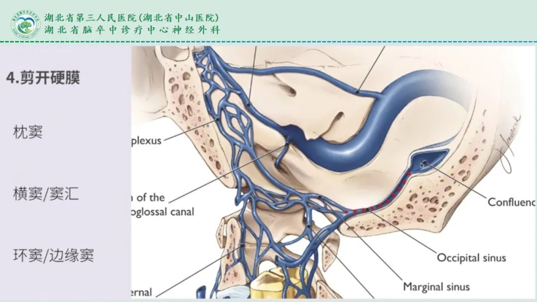 扁桃体周围血管解剖图图片