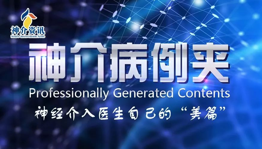 国产中间导管Passageway在复杂径路颅内动脉瘤介入治疗中的初步应用经验 - 脑医汇